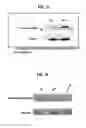 Fig. 16 - Antibodies to endoplasmin and their use