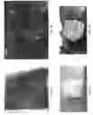 Fig. 02 - Fiber reinforced tissue composites