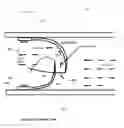 Fig. 01 - Flexible check valve for fluid control