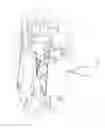Fig. 07 - Rope arrest-and-release device for use on utility poles
