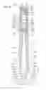 Fig. 05 - Illuminating tweezers