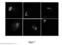Fig. 04 - Crystalline particle detection