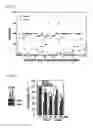 Fig. 11 - Composition for anticancer adjuvant comprising RIP3 expression promoter as active ingredient, method for screening anticancer adjuvant which promotes RIP3 expression and enhances sensitivity of anticancer agent, and method for monitoring sensitivity of anticancer agent