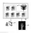 Fig. 02 - Method and program for computing bone age by deep neural network