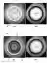 Fig. 04 - Contact lens inspection in a plastic shell