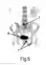 Fig. 09 - Nuclear medical image analysis technique