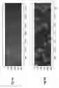 Fig. 07 - Auto-referencing in digital holographic microscopy reconstruction