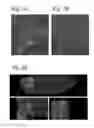 Fig. 02 - Magnetic resonance imaging with enhanced bone visualization