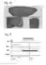 Fig. 03 - Magnetic resonance imaging with enhanced bone visualization