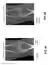 Fig. 07 - METHOD FOR ENHANCED DISPLAY OF IMAGE SLICES FROM 3-D VOLUME IMAGE