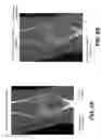 Fig. 08 - METHOD FOR ENHANCED DISPLAY OF IMAGE SLICES FROM 3-D VOLUME IMAGE