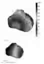Fig. 03 - System for visualizing heart activation