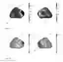 Fig. 10 - System for visualizing heart activation