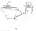 Fig. 02 - Diathermy Knife Ionisation Source