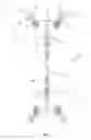 Fig. 02 - Motion control device for overhead transmission lines