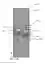 Fig. 01 - Methods and systems for controllably moving multiple moveable stages in a displacement device