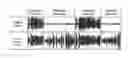 Fig. 01 - Volume-levelling processing