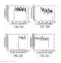 Fig. 06 - Detecting a folded page in a digital image of a scanned document