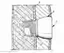 Fig. 01 - Implant abutment