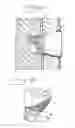 Fig. 02 - Implant abutment