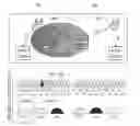 Fig. 01 - Method, device and system for detecting interferences