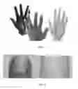 Fig. 02 - Assistive glove for artificial hands