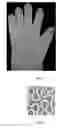 Fig. 03 - Assistive glove for artificial hands