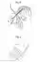 Fig. 04 - Imaging device for measuring characteristics of a hair or a scalp