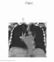 Fig. 10 - Medical image display device and medical image processing method