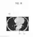 Fig. 20 - Medical image display device and medical image processing method