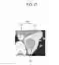 Fig. 22 - Medical image display device and medical image processing method