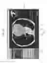 Fig. 23 - Medical image display device and medical image processing method