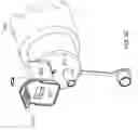 Fig. 82 - Specimen collection cassette for retrieving tissue samples from a fluid stream generated during a medical/surgical procedure