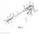 Fig. 02 - Methods and devices for delivering and securing adjunct materials to a treatment site