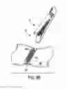 Fig. 17 - Methods and devices for delivering and securing adjunct materials to a treatment site