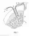 Fig. 08 - GRAFT FIXATION USING A PLUG AGAINST SUTURE