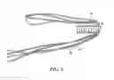 Fig. 09 - Graft fixation using a plug against suture