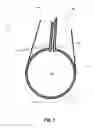 Fig. 02 - Luminal grafts and methods of making and using the same