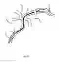 Fig. 02 - Catheter and a retrieval system using the catheter