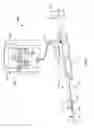Fig. 02 - Atherectomy devices and methods