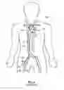 Fig. 03 - High torsion delivery catheter element