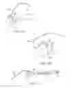 Fig. 22 - Apparatus and methods for accessing and sealing bodily vessels and cavities
