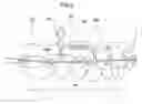 Fig. 07 - Medical device, device structures for dentistry, for head and neck surgery and for orthopedic surgery, and method for bonding medical device to bone