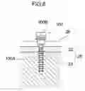 Fig. 10 - Medical device, device structures for dentistry, for head and neck surgery and for orthopedic surgery, and method for bonding medical device to bone
