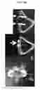 Fig. 13 - Medical device, device structures for dentistry, for head and neck surgery and for orthopedic surgery, and method for bonding medical device to bone