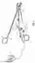 Fig. 02 - Method of assembling an electrosurgical instrument