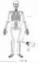 Fig. 02 - System and method for robotic surgery
