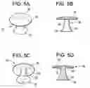 Fig. 06 - Surgical Implant
