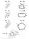 Fig. 05 - Baroreceptor testing prior to implantation methods and apparatus