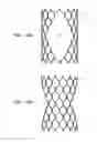 Fig. 20 - Baroreceptor testing prior to implantation methods and apparatus
